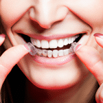 Czy Aparat na Zęby Niewidoczny to Najlepsza Opcja dla Twoich Potrzeb Stomatologicznych?